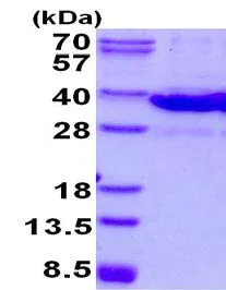 SDS-PAGE - Recombinant Mouse Galectin 8/Gal-8 protein (His tag N-Terminus) (AB134629)