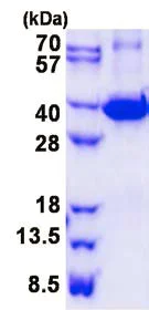 SDS-PAGE - Recombinant Mouse galectin 9/Gal-9 protein (denatured) (His tag N-Terminus) (AB139256)