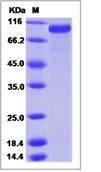 SDS-PAGE - Recombinant Mouse GAS 6 protein (His tag) (AB277020)