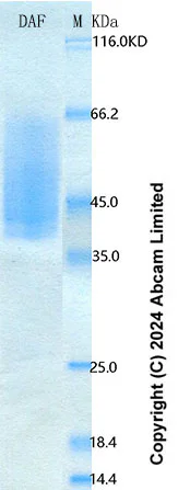 SDS-PAGE - Recombinant Mouse GAS6 Protein Standard (His tag) (AB323389)