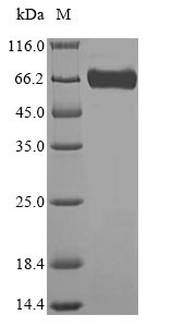SDS-PAGE - Recombinant Mouse GBA protein (Tagged) (AB235724), expandable thumbnail