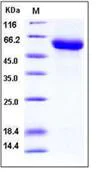 SDS-PAGE - Recombinant Mouse GDNF Receptor alpha 1/GFRA1 protein (His tag) (AB276784)