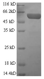 SDS-PAGE - Recombinant Mouse GFAP protein (His tag) (AB226309)