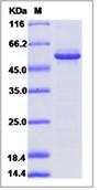 SDS-PAGE - Recombinant Mouse GFOD2 protein (His tag) (AB277013), expandable thumbnail
