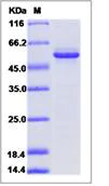 SDS-PAGE - Recombinant Mouse GFOD2 protein (His tag) (AB277013)