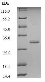 SDS-PAGE - Recombinant Mouse GLP-1R protein (His tag) (AB226315)