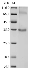 SDS-PAGE - Recombinant Mouse GPCR GPR146 protein (AB289775)