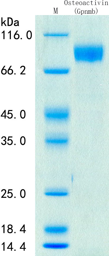 SDS-PAGE - Recombinant Mouse GPNMB Protein Standard (His tag) (AB316402), expandable thumbnail