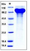 SDS-PAGE - Recombinant Mouse Granulin protein (His tag) (AB276835)