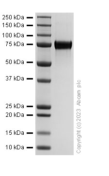 Recombinant Mouse GRN Protein (His tag)