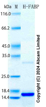 SDS-PAGE - Recombinant Mouse H-FABP Protein Standard (His tag) (AB316713), expandable thumbnail