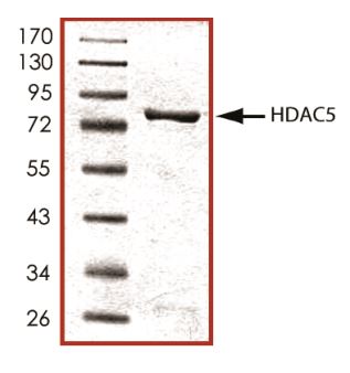 Recombinant mouse HDAC5 protein (Active)