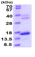 SDS-PAGE - Recombinant Mouse Hemoglobin subunit zeta protein (His tag) (AB229362), expandable thumbnail