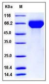 SDS-PAGE - Recombinant Mouse Hemopexin protein (His tag) (AB276805), expandable thumbnail