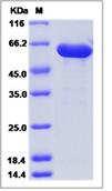 SDS-PAGE - Recombinant Mouse HEXB protein (His tag) (AB277010)