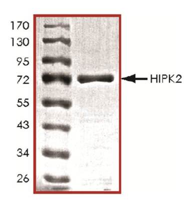 Recombinant mouse HIPK2 protein