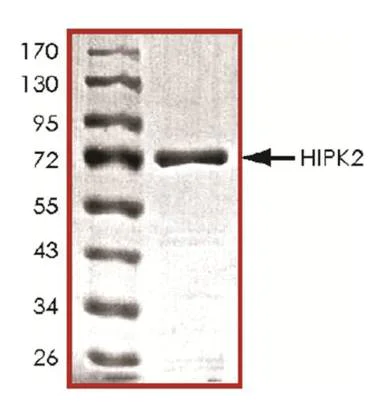 SDS-PAGE - Recombinant mouse HIPK2 protein (AB125553)