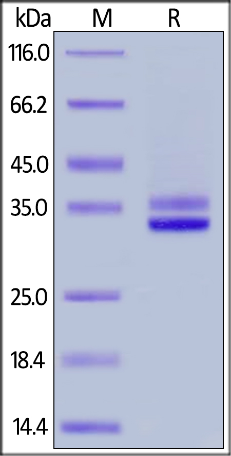 SDS-PAGE - Recombinant Mouse HMGB1 protein (His tag) (AB255799)