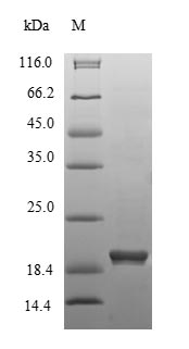 SDS-PAGE - Recombinant Mouse HMGCR protein (His tag) (AB235715), expandable thumbnail