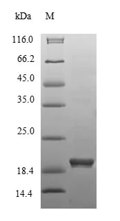 SDS-PAGE - Recombinant Mouse HMGCR protein (His tag) (AB235715)