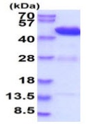 SDS-PAGE - Recombinant Mouse HPD protein (His tag) (AB233599), expandable thumbnail
