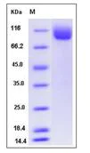 SDS-PAGE - Recombinant Mouse I100 protein (His tag) (AB276943)