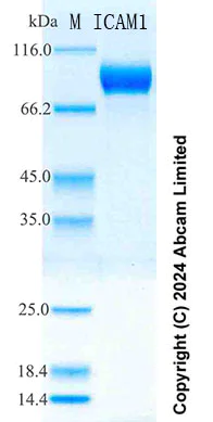 SDS-PAGE - Recombinant Mouse ICAM 1 Protein Standard (His tag) (AB322281)