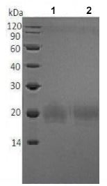 SDS-PAGE - Recombinant Mouse ICOS protein (His tag) (AB215625)