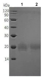 SDS-PAGE - Recombinant Mouse ICOS protein (His tag) (AB215625)