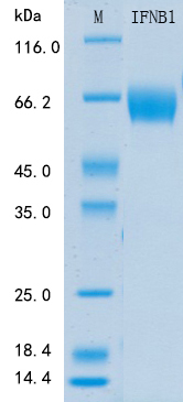 Recombinant Mouse IFN beta Protein Standard (His tag)