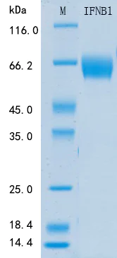 SDS-PAGE - Recombinant Mouse IFN beta Protein Standard (His tag) (AB316395)