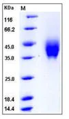 SDS-PAGE - Recombinant Mouse IFN gamma Receptor beta/AF-1 protein (His tag) (AB276895)
