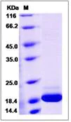 SDS-PAGE - Recombinant mouse IFNA14 protein (His tag) (AB276896)