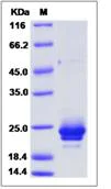 SDS-PAGE - Recombinant Mouse IFNA5 protein (His tag) (AB276985)