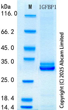 SDS-PAGE - Recombinant Mouse IGFBP1 Protein Standard (His tag) (AB316618)