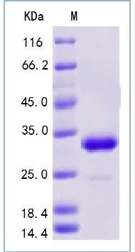 SDS-PAGE - Recombinant Mouse IgG protein (AB276304)