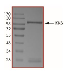 SDS-PAGE - Recombinant mouse IKK beta protein (Active) (AB268658), expandable thumbnail