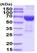 SDS-PAGE - Recombinant Mouse IL-17RB protein (Fc Chimera His Tag) (AB222948)
