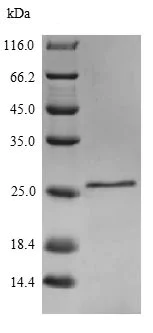 SDS-PAGE - Recombinant Mouse IL-18 protein (His tag) (AB240849)