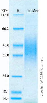 SDS-PAGE - Recombinant Mouse IL-18BP Protein Standard (His tag) (AB316591)