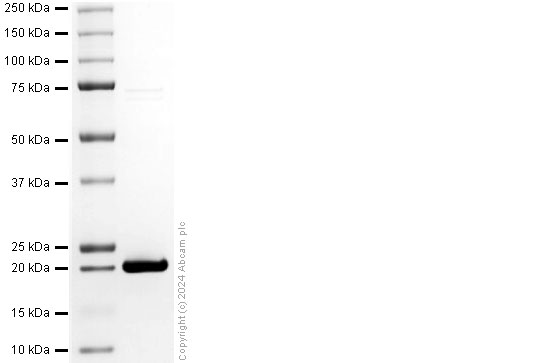 SDS-PAGE - Recombinant Mouse IL-1F10 protein (His tag) (AB318257), expandable thumbnail