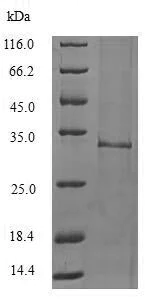 SDS-PAGE - Recombinant Mouse IL-1F10 protein (Tagged) (AB239445)