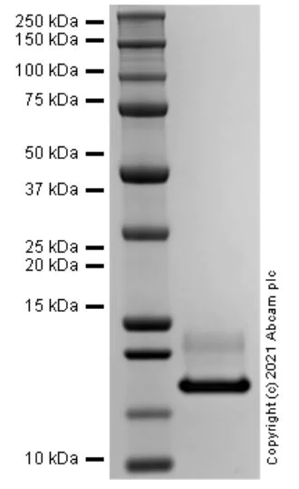 SDS-PAGE - Recombinant Mouse IL-1RA protein (Active) (AB283475)