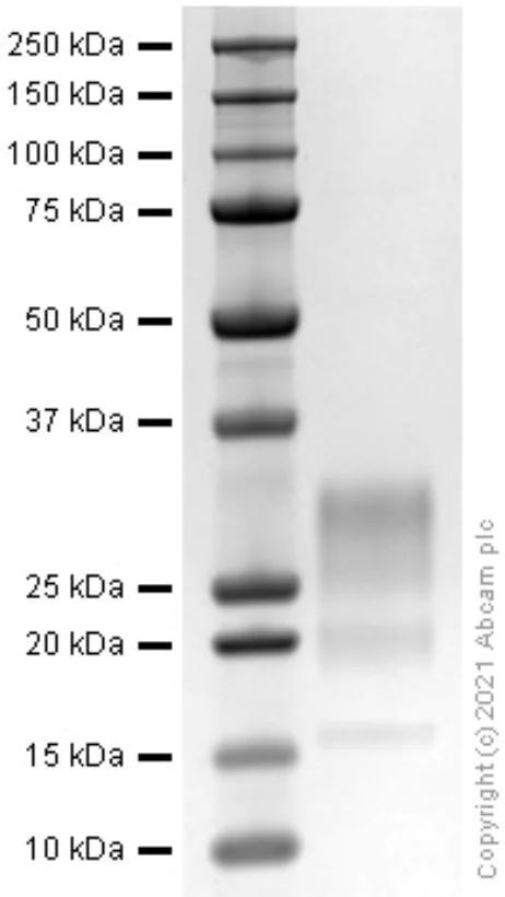 SDS-PAGE - Recombinant mouse IL-22 protein (Active) (AB281809)
