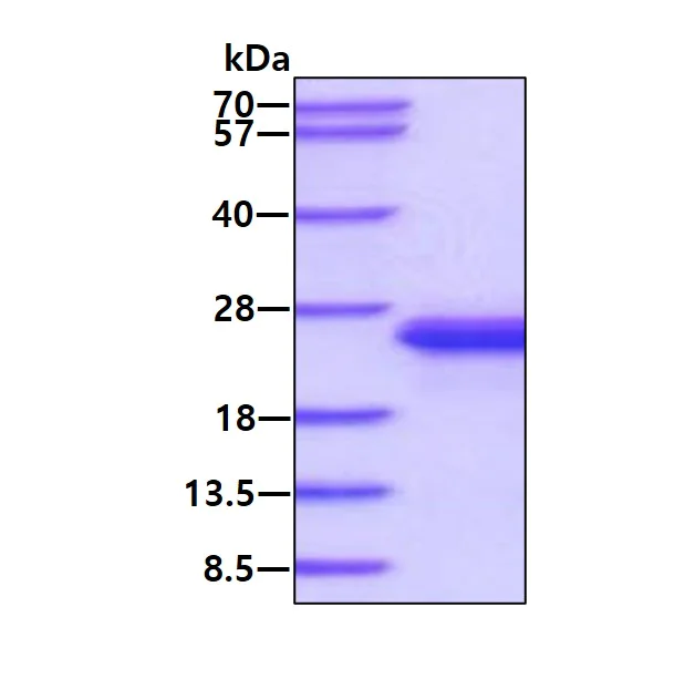 SDS-PAGE - Recombinant Mouse IL-33 protein (AB187455)