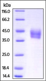 SDS-PAGE - Recombinant Mouse IL-4R protein (His tag) (AB221203), expandable thumbnail