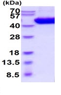SDS-PAGE - Recombinant Mouse IL-5RA protein (His tag C-Terminus) (AB222449)