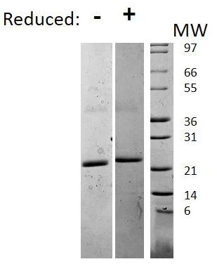 SDS-PAGE - Recombinant mouse IL-6 protein (AB198572)