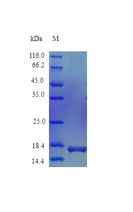 SDS-PAGE - Recombinant mouse IL-6 protein (Active) (AB243170)