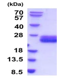 SDS-PAGE - Recombinant mouse IL-6 protein (Active) (His tag C-Terminus) (AB208475)